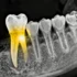 Next-Generation AI Revolutionizes Dental Diagnostics Through Automated Periapical Assessment - Professional coverage